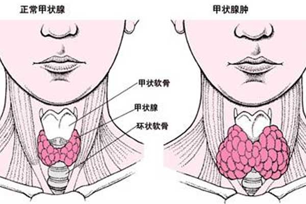 甲状腺功能