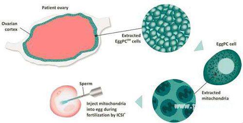 第四代试管婴儿流程图